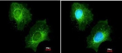 Immunocytochemistry/ Immunofluorescence - Anti-ECHS1 antibody (AB153732), expandable thumbnail