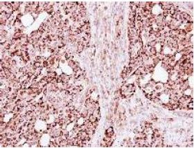 Immunohistochemistry (Formalin/PFA-fixed paraffin-embedded sections) - Anti-ECHS1 antibody (AB153732), expandable thumbnail