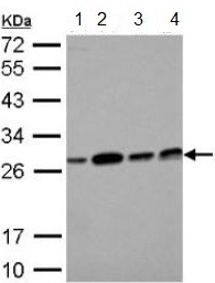 Western blot - Anti-ECHS1 antibody (AB153732), expandable thumbnail