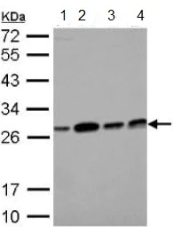 Western blot - Anti-ECHS1 antibody (AB153732)