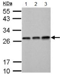 Western blot - Anti-ECHS1 antibody (AB153732), expandable thumbnail
