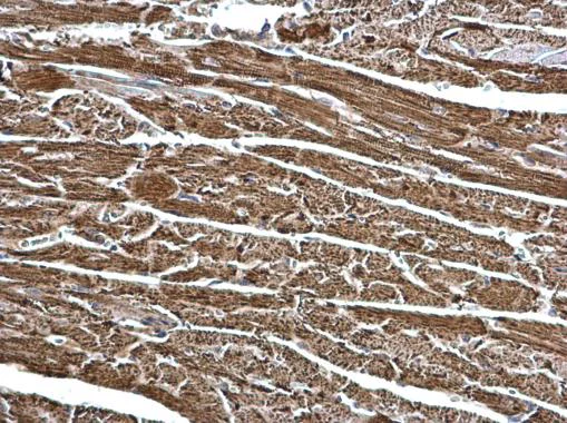 Immunohistochemistry (Formalin/PFA-fixed paraffin-embedded sections) - Anti-ECHS1 antibody (AB228631)