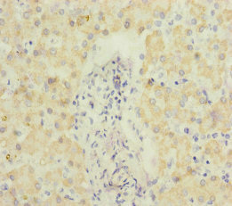 Immunohistochemistry (Formalin/PFA-fixed paraffin-embedded sections) - Anti-ECHS1 antibody (AB235835)