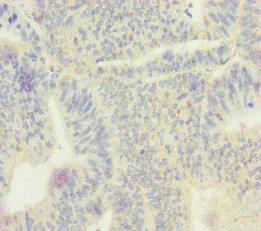 Immunohistochemistry (Formalin/PFA-fixed paraffin-embedded sections) - Anti-ECHS1 antibody (AB235835)