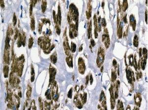 Immunohistochemistry (Formalin/PFA-fixed paraffin-embedded sections) - Anti-ECHS1 antibody [EPR11784(B)] (AB170108)