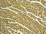 Immunohistochemistry (Formalin/PFA-fixed paraffin-embedded sections) - Anti-ECHS1 antibody [EPR11785] (AB174312)