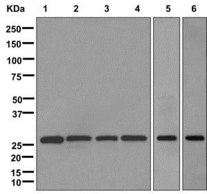 Western blot - Anti-ECHS1 antibody [EPR11785] - BSA and Azide free (AB249811)