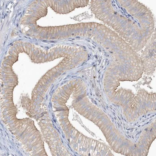 Immunohistochemistry (Formalin/PFA-fixed paraffin-embedded sections) - Anti-ECM antibody (AB244451)