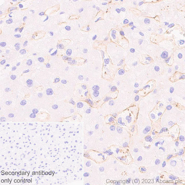 Immunohistochemistry (Formalin/PFA-fixed paraffin-embedded sections) - Anti-ECM Isoform 1 antibody [EPR25810-46] (AB314893)