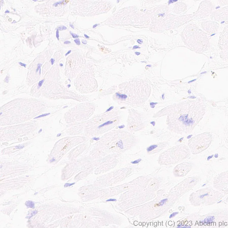 Immunohistochemistry (Formalin/PFA-fixed paraffin-embedded sections) - Anti-ECM Isoform 1 antibody [EPR25810-46] (AB314893)