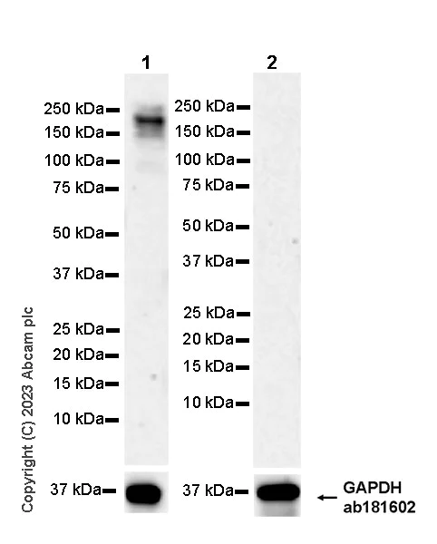 Western blot - Anti-ECM Isoform 1 antibody [EPR25810-46] (AB314893)