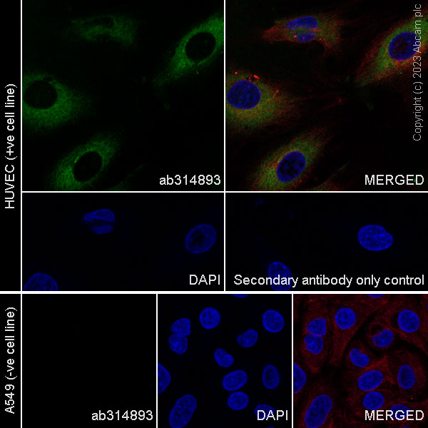 Immunocytochemistry/ Immunofluorescence - Anti-ECM Isoform 1 antibody [EPR25810-46] - BSA and Azide free (AB314894), expandable thumbnail