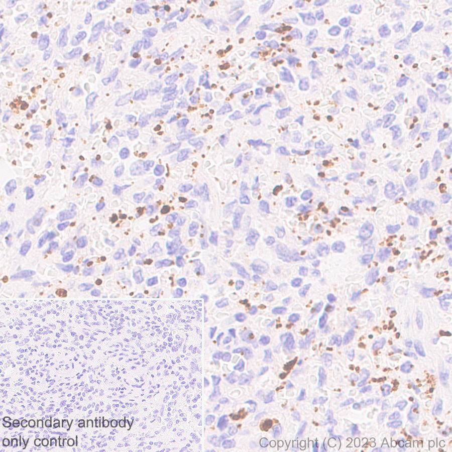 Immunohistochemistry (Formalin/PFA-fixed paraffin-embedded sections) - Anti-ECM Isoform 1 antibody [EPR25810-46] - BSA and Azide free (AB314894), expandable thumbnail