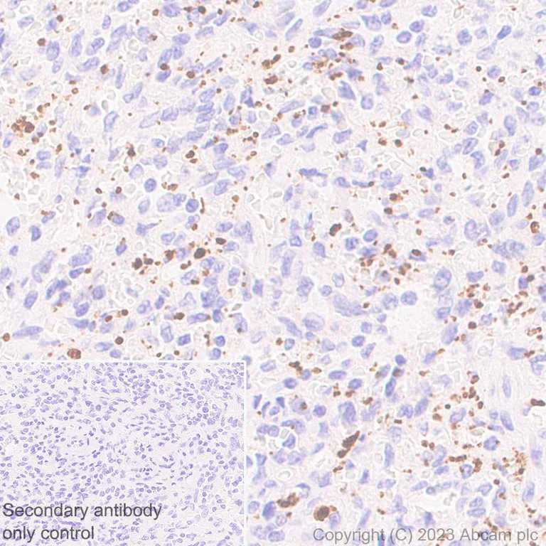 Immunohistochemistry (Formalin/PFA-fixed paraffin-embedded sections) - Anti-ECM Isoform 1 antibody [EPR25810-46] - BSA and Azide free (AB314894)