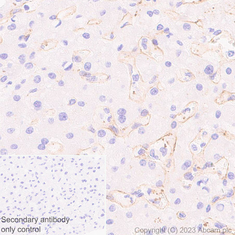 Immunohistochemistry (Formalin/PFA-fixed paraffin-embedded sections) - Anti-ECM Isoform 1 antibody [EPR25810-46] - BSA and Azide free (AB314894), expandable thumbnail