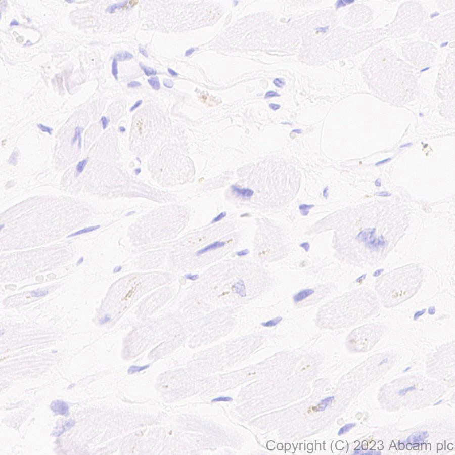 Immunohistochemistry (Formalin/PFA-fixed paraffin-embedded sections) - Anti-ECM Isoform 1 antibody [EPR25810-46] - BSA and Azide free (AB314894), expandable thumbnail