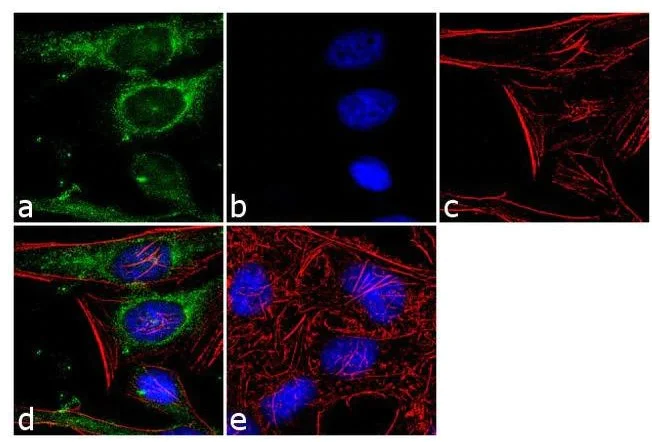 Immunocytochemistry/ Immunofluorescence - Anti-ECM29 antibody (AB28666)