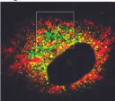 Immunocytochemistry/ Immunofluorescence - Anti-ECM29 antibody (AB28666)