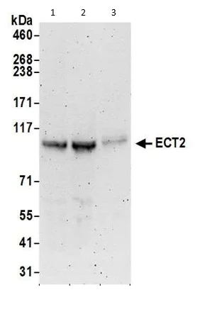 Western blot - Anti-ECT2 antibody (AB86604)