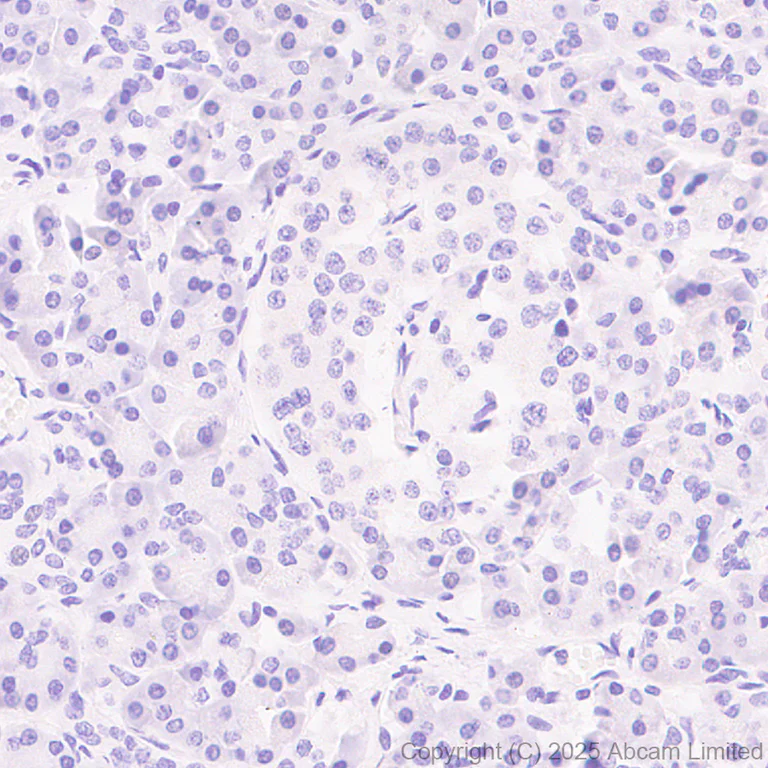 Immunohistochemistry (Formalin/PFA-fixed paraffin-embedded sections) - Anti-ECT2 antibody [ECO311E] (AB324657)