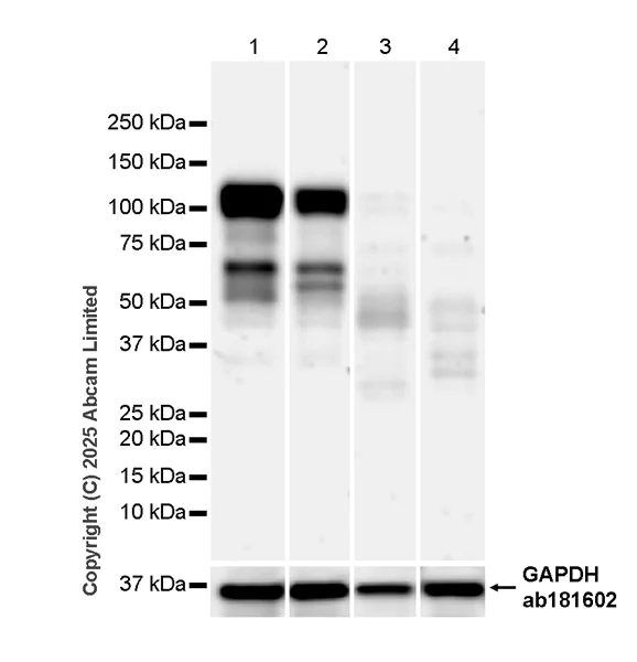 Western blot - Anti-ECT2 antibody [ECO311E] (AB324657)