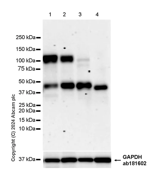 Western blot - Anti-ECT2 antibody [EPR29014-24] - BSA and Azide free (AB317826)