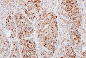 Immunohistochemistry (Formalin/PFA-fixed paraffin-embedded sections) - Anti-ECT2 antibody - N-terminal (AB151503), expandable thumbnail
