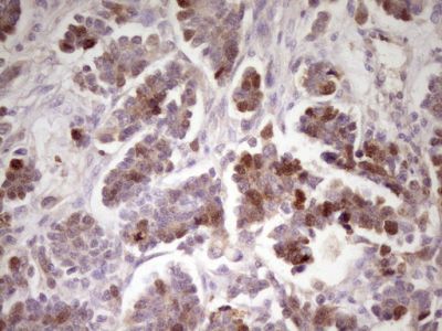 Immunohistochemistry (Formalin/PFA-fixed paraffin-embedded sections) - Anti-ECT2 antibody [OTI2D9] (AB236502)