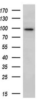 Western blot - Anti-ECT2 antibody [OTI2D9] (AB236502)