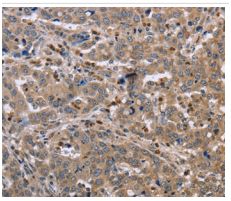 Immunohistochemistry (Formalin/PFA-fixed paraffin-embedded sections) - Anti-EDA antibody (AB198022)
