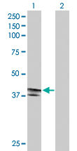 Western blot - Anti-EDA2R/XEDAR antibody (AB167224), expandable thumbnail