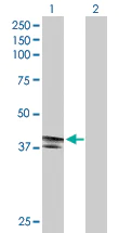 Western blot - Anti-EDA2R/XEDAR antibody (AB167224)