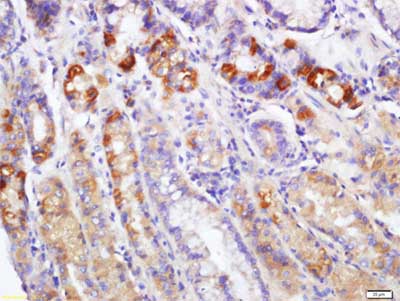 Immunohistochemistry (Formalin/PFA-fixed paraffin-embedded sections) - Anti-EDA2R/XEDAR antibody (AB203667)