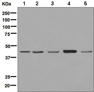 Western blot - Anti-EDAR antibody [EPR8020] (AB137021), expandable thumbnail