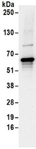 Immunoprecipitation - Anti-EDC3 antibody (AB168851), expandable thumbnail