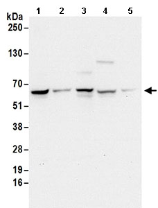 Western blot - Anti-EDC3 antibody (AB168851), expandable thumbnail