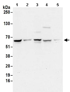 Western blot - Anti-EDC3 antibody (AB168851)