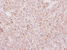 Immunohistochemistry (Formalin/PFA-fixed paraffin-embedded sections) - Anti-EDC4 antibody (AB154026)