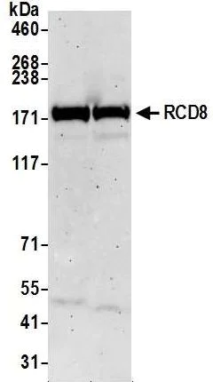 Western blot - Anti-EDC4 antibody (AB72408)