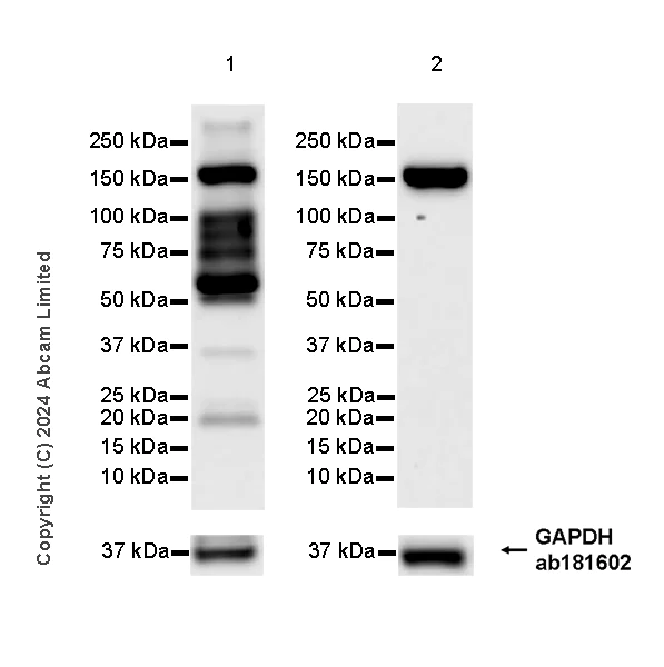 Western blot - Anti-EDC4 antibody [EPR28929-24] (AB321984)