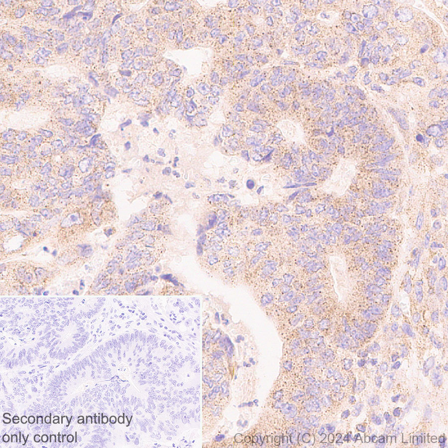 Immunohistochemistry (Formalin/PFA-fixed paraffin-embedded sections) - Anti-EDC4 antibody [EPR28929-24] - BSA and Azide free (AB321985), expandable thumbnail