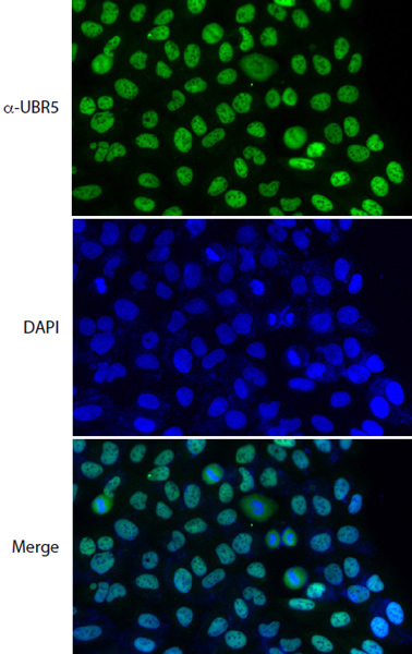 Immunocytochemistry/ Immunofluorescence - Anti-EDD antibody (AB175810)