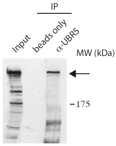 Immunoprecipitation - Anti-EDD antibody (AB175810)