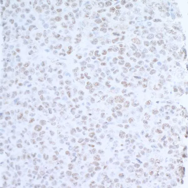 Immunohistochemistry (Formalin/PFA-fixed paraffin-embedded sections) - Anti-EDD antibody (AB70311)