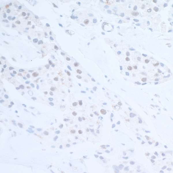 Immunohistochemistry (Formalin/PFA-fixed paraffin-embedded sections) - Anti-EDD antibody (AB70311)