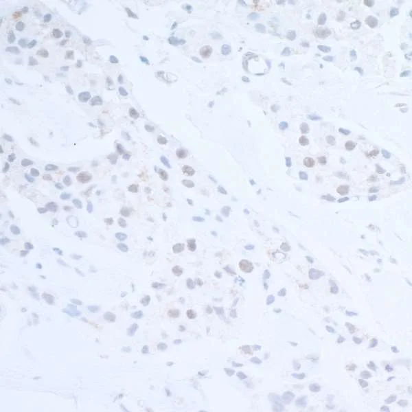 Immunohistochemistry (Formalin/PFA-fixed paraffin-embedded sections) - Anti-EDD antibody (AB70311)