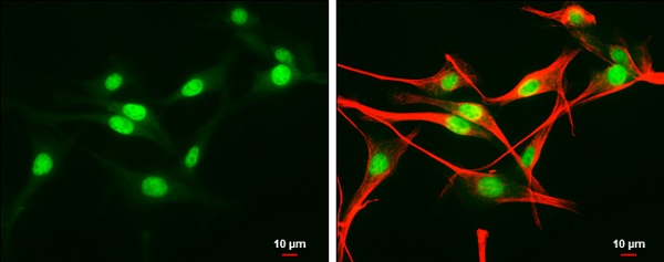 Immunocytochemistry/ Immunofluorescence - Anti-EDD antibody - C-terminal (AB226792), expandable thumbnail