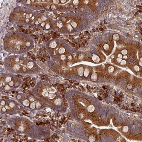 Immunohistochemistry (Formalin/PFA-fixed paraffin-embedded sections) - Anti-EDEM2 antibody (AB204173)