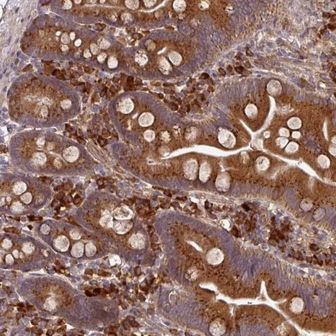 Immunohistochemistry (Formalin/PFA-fixed paraffin-embedded sections) - Anti-EDEM2 antibody (AB204173)