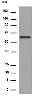 Western blot - Anti-EDEM2 antibody [EPR14043-24] (AB180522)